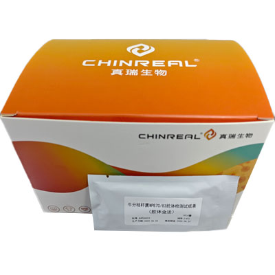 牛分枝杆菌MPB70/83抗体检测试纸条（胶体金法）